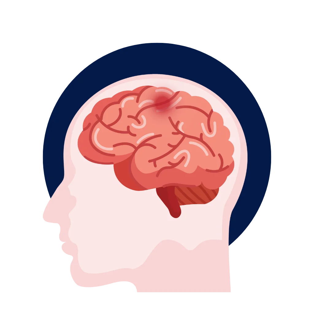 We Cure Rehab Physiotherapy Clinic Oshawa - Stroke image